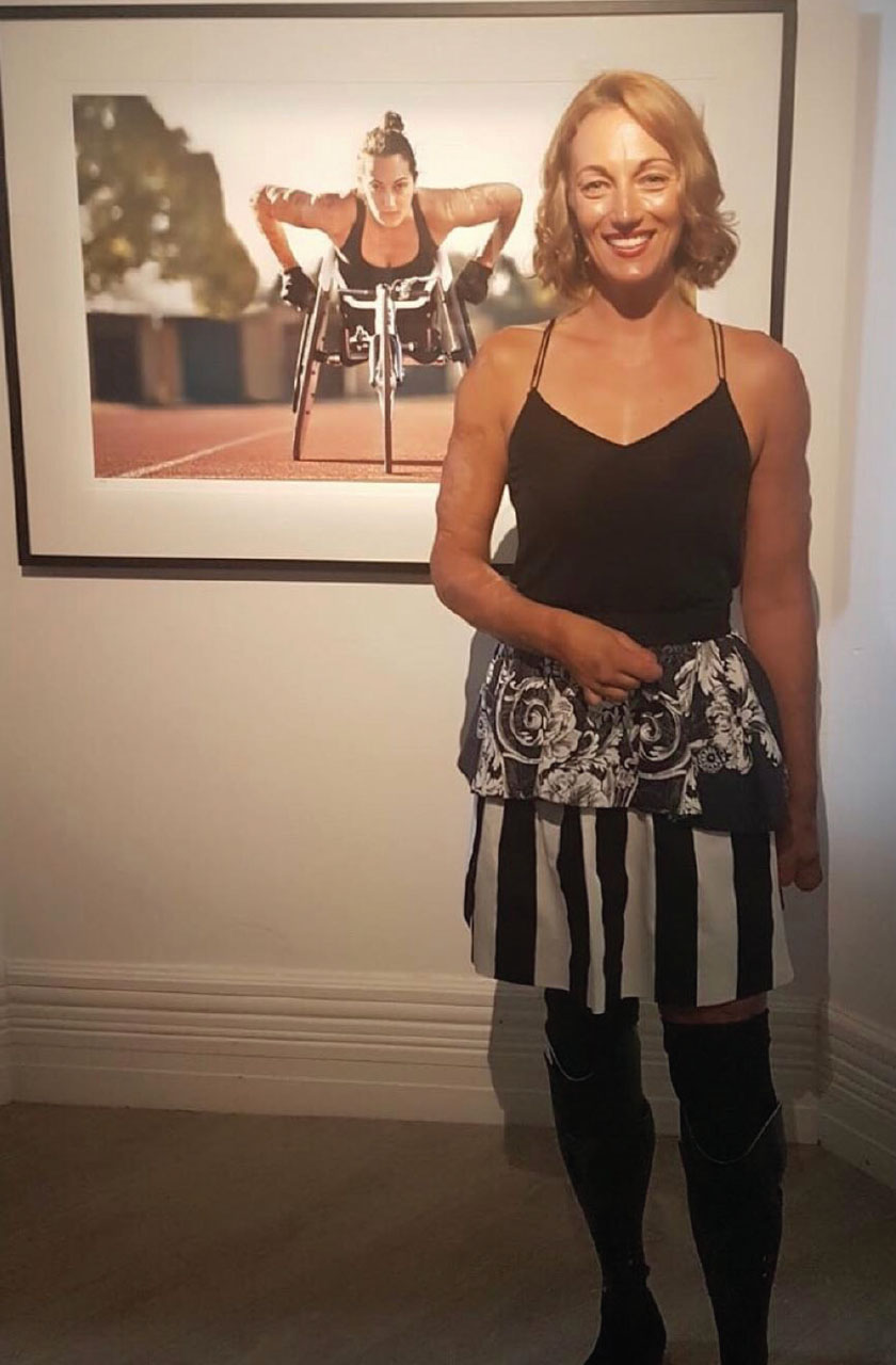 Eliza Standing in a room where a picture of her riding wheelchair is hanged. She is wearing black top and black & white lined skirt.